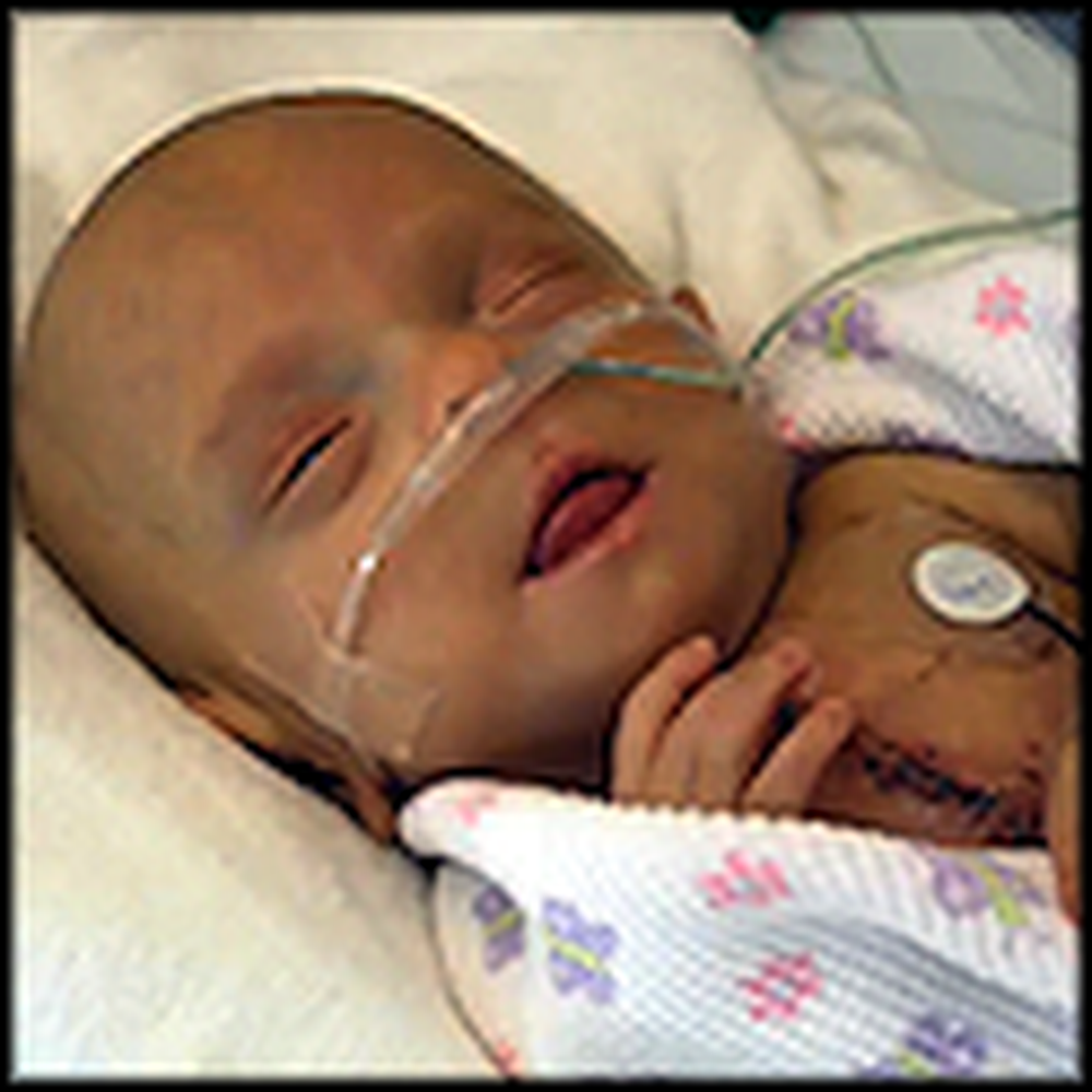 The Sad But Inspiring Story of a One Pound Miracle Baby