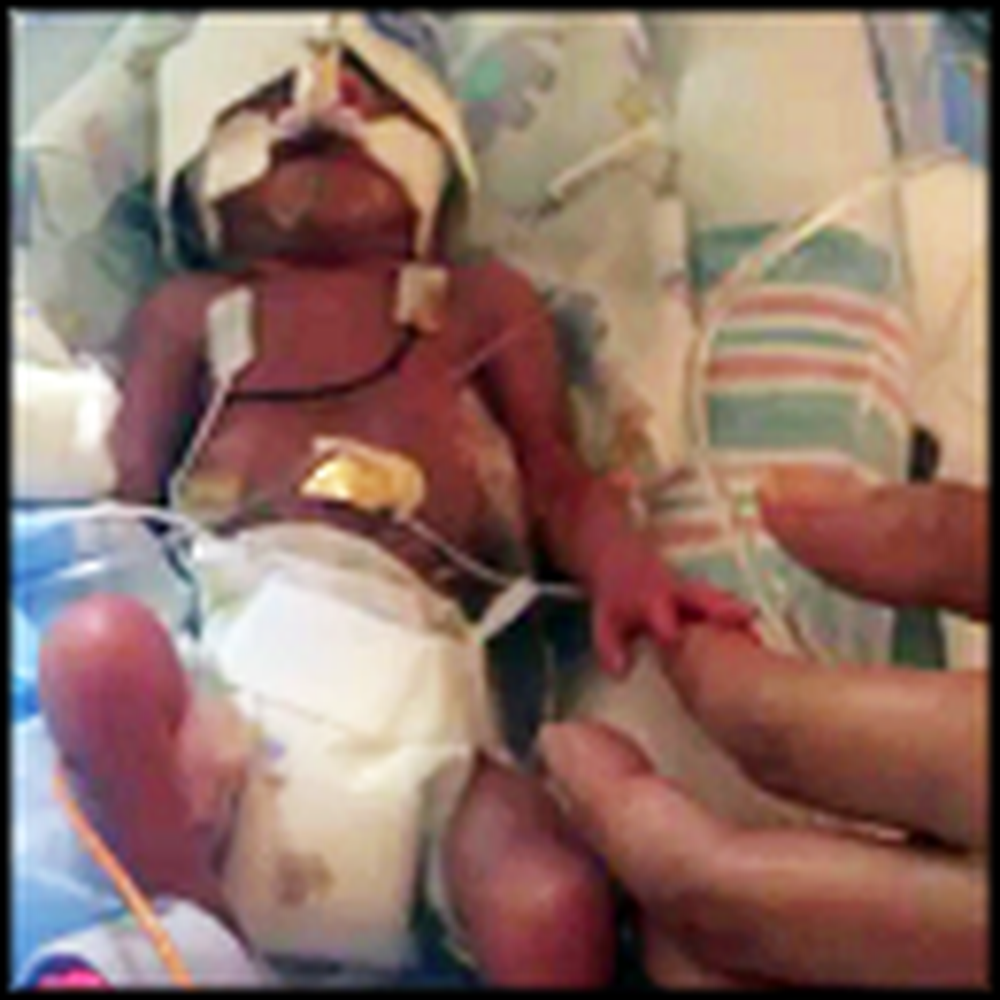 Ezekiel's Miracle - Baby Weighing 1 Pound Shocks Doctors