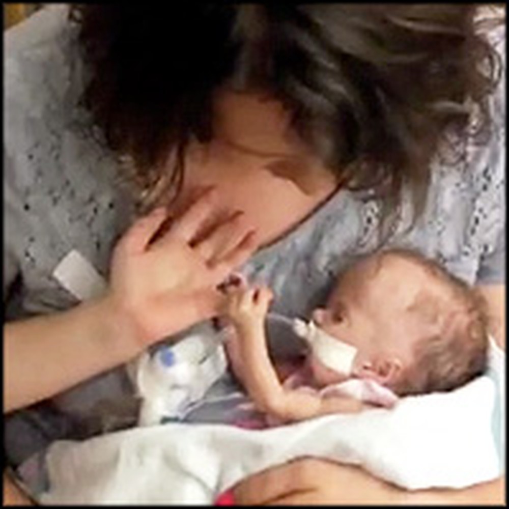 Family Sings Amazing Grace to Baby Twin Just Before She Passed Away
