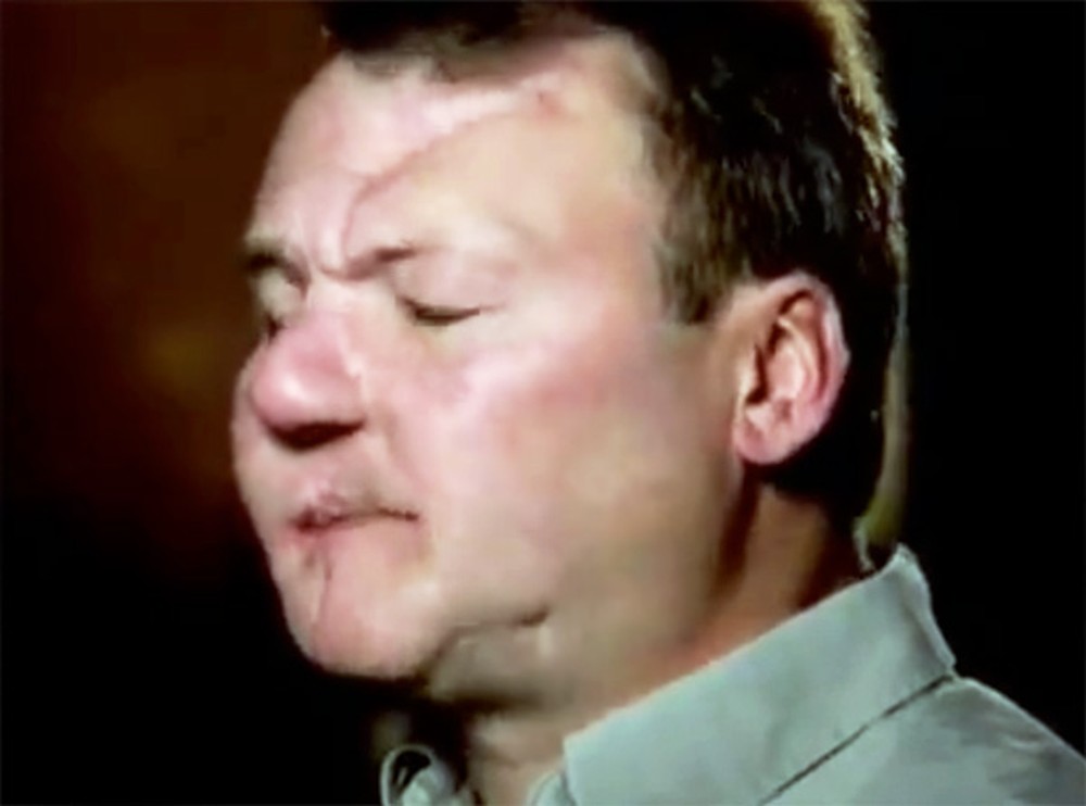 Meth Addict Experiences a Miracle After Shooting Himself in the Face