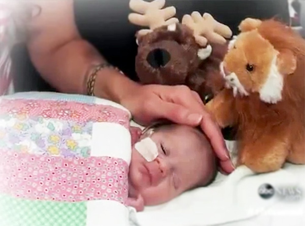 Doctors Said This Baby Was Not Compatible With Life - Then, Something Miraculous Happened.