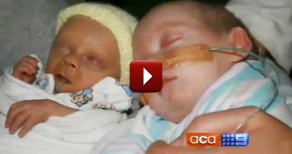 They Were Told to Abort One of their Twins - But Watch This
