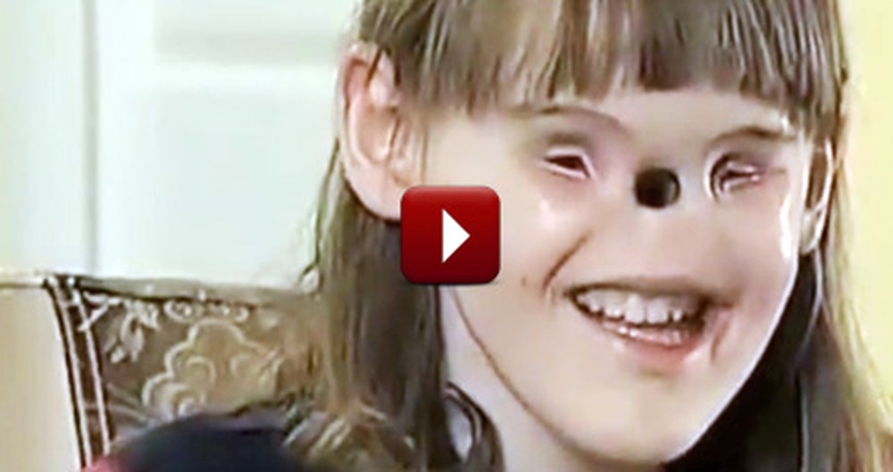 Girl Born With No Eyes or Nose Receives a Miracle