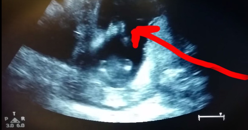 Unborn Baby Amazed Doctor Doing THIS!