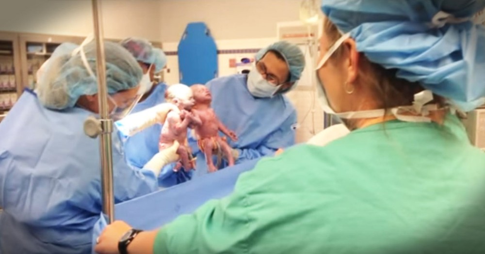 Twins Born Holding Hands Are Truly A Miracle