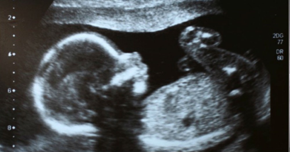 This Mom Was Ready To Abort, Until God Showed Her THIS At The Clinic!