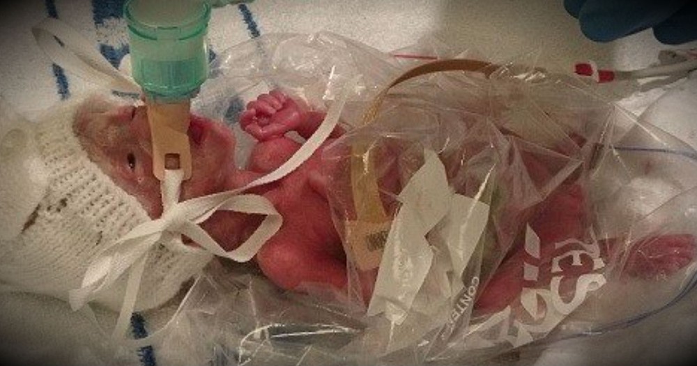 This Miracle Baby Is Alive Today After Being Placed In A Plastic Bag