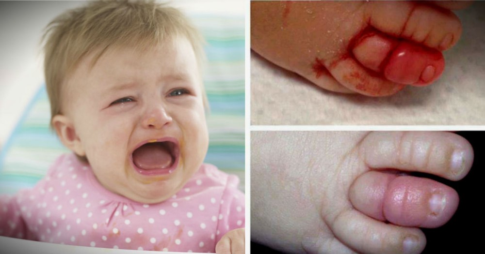 Dad Shares Photos Of His Baby's Toe To Warn Others Of This DANGER!
