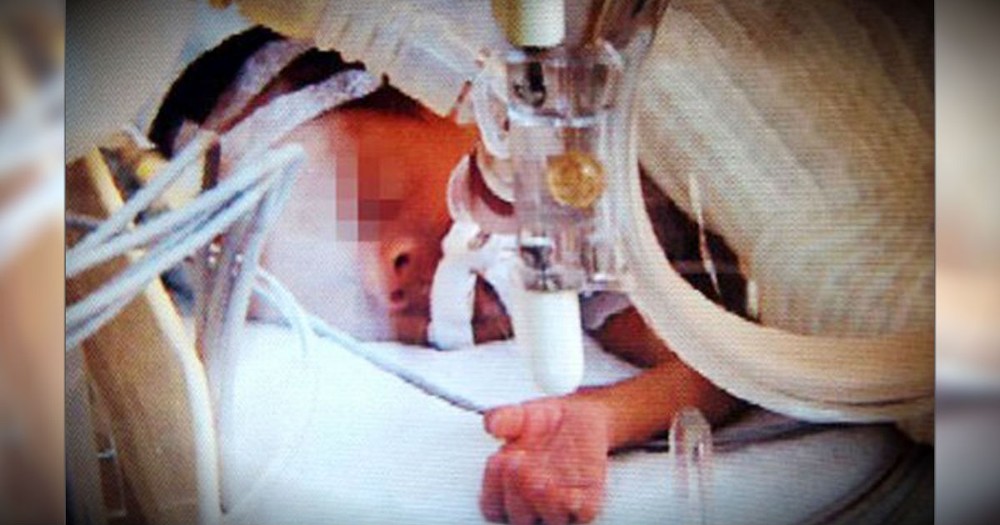 A Miracle Baby Comes Back To Life Just Before Being Cremated!