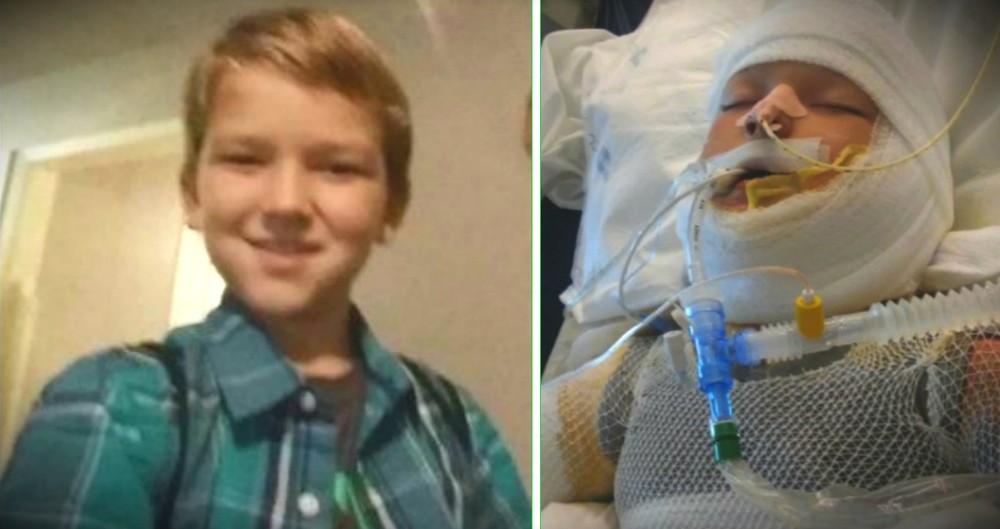 10-Year-Old With Special Needs Fights For Life After Being Set On Fire