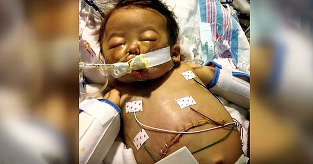 5-Month-Old Receives Life-Saving Organ Donation In A Matter Of Minutes