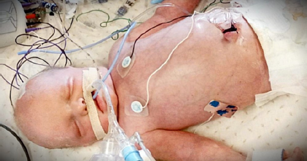 Baby Boy Born With No Heartbeat Gets A Miracle As Mom Nurses Him