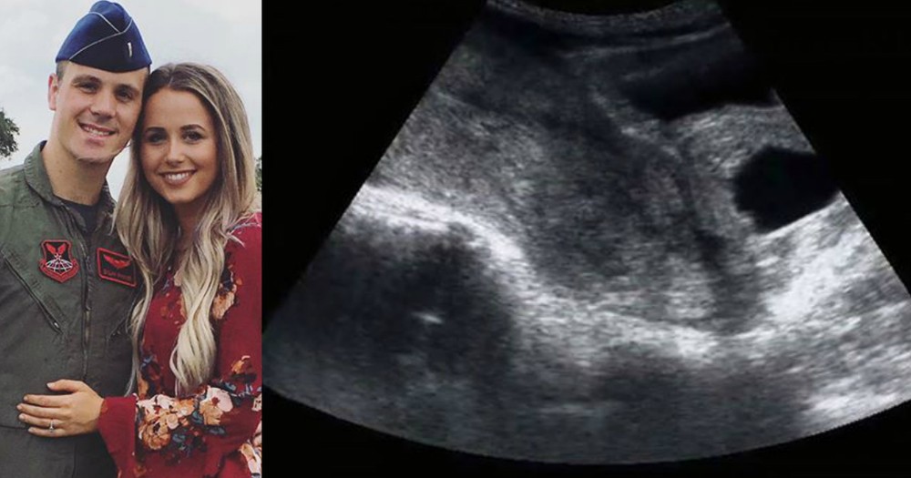 Emotional Post About 8-Week Ultrasound She Knew 'Wasn't Right'
