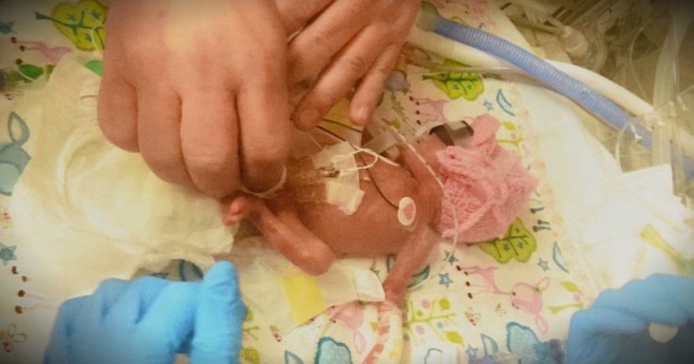 Miracle Baby With Feet The Size Of Pennies Overcame Meningitis