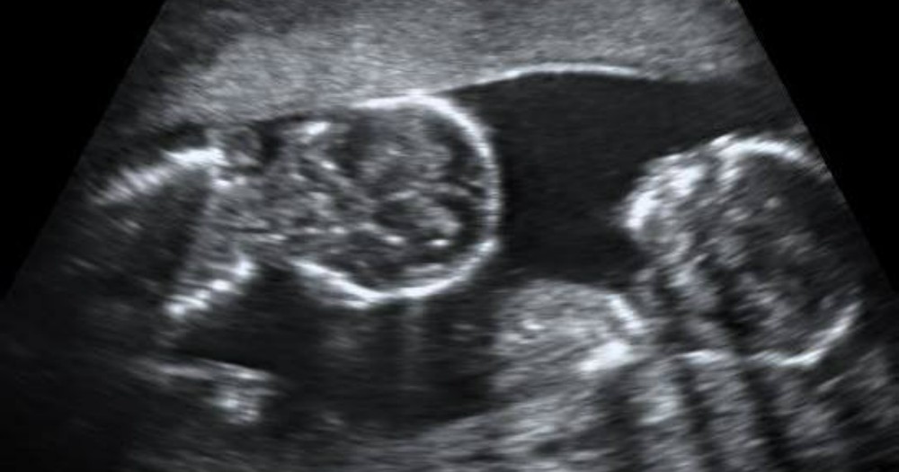 Two Babies Talk In The Womb And Perfectly Explain God