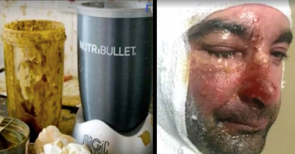 Some Owners Warn That NutriBullets Are Exploding, Causing Awful Injuries