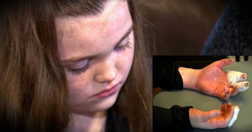 Girl Suffers Horrible Accident From Popular Kids' Do-It-Yourself Project