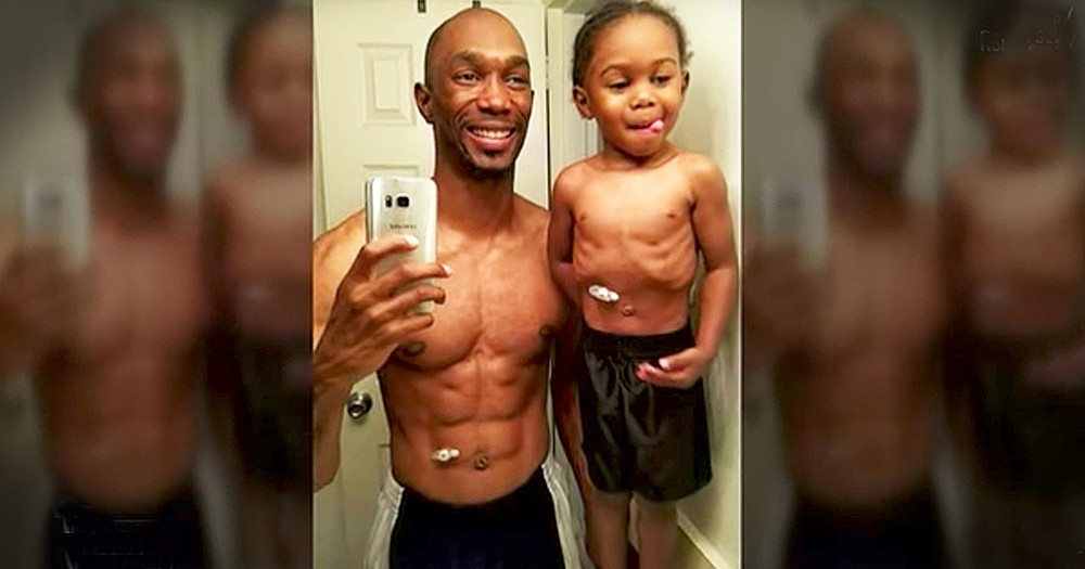 Dad Poses With 3-Year-Old With A Feeding Tube In A Special Photo
