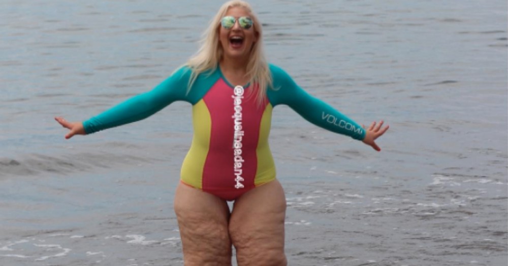 Woman Loses 350 Pounds, Then Bullies Nearly Ruined Her Beach Vacation
