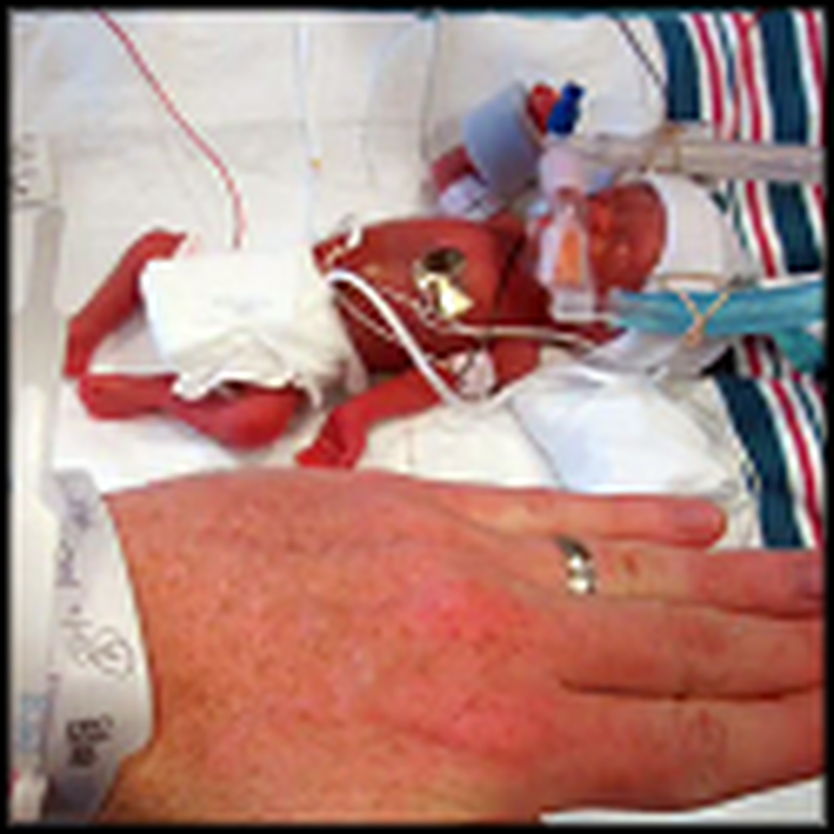 What Happens to this 1 Pound Miracle Baby Will Move You So Much a
