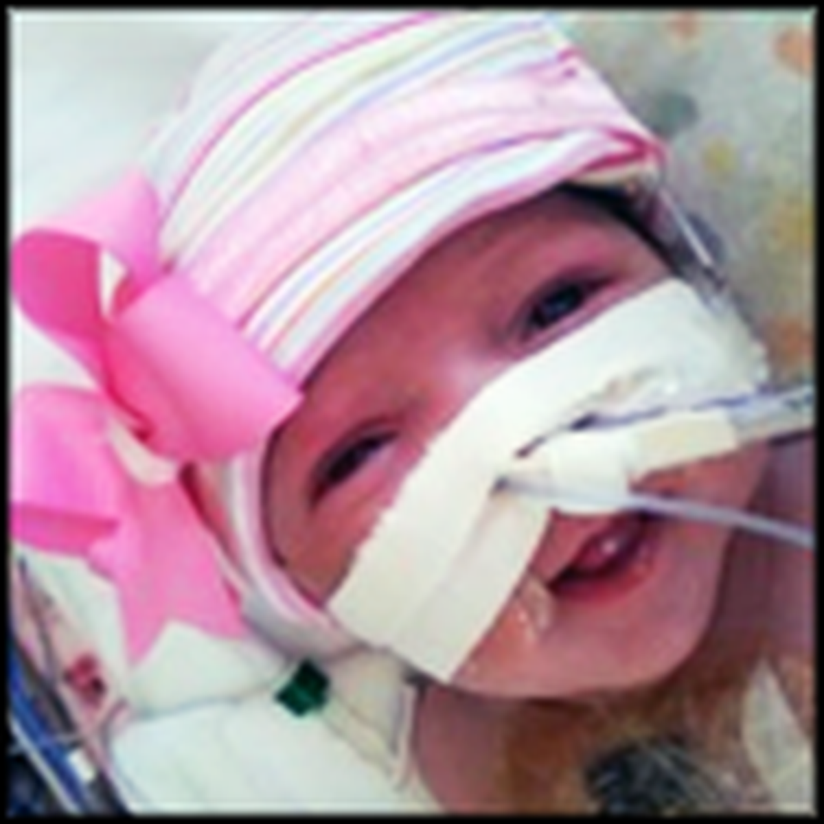 Baby Girl is Born Without a Heart in Her Body - and She SURVIVES 