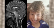 Doctors Said Their 6-Year-Old Boy Would Die, but He's a Living Miracle and Medical Marvel, Too