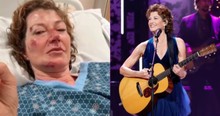 Singer Amy Grant Opens up about Challenges She Still Faces Due to Her Bike Accident
