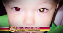 Photo On Facebook Alerts Mom About Her Son's Eye Cancer