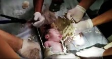 Baby Gets Miraculous Rescue After He Slips Down The Toilet Drain