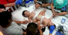 Parents Pray Over Conjoined Twins Separated In Texas And Praise God As The Boys Head Home