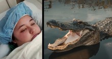 Teen's Harrowing Story Of How A 12-Foot Crocodile Tried Dragging Her To The Ocean
