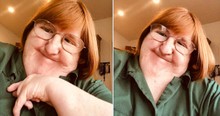 Told She's 'Too Ugly' to Post Selfies, Woman with Freeman-Sheldon Syndrome Has Best Response