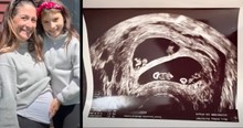 Mom Who Lost 4 Babies Discovers She's Pregnant With 2 Sets of Identical Twins