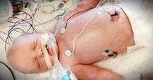 Baby Boy Born With No Heartbeat Gets A Miracle As Mom Nurses Him