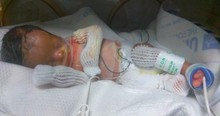 Baby Born With No Skin Baffles Doctors And His Family Needs Prayer