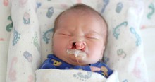 Parents Of Baby With Severe Cleft Palate Have Faith Restored By Kind Stranger