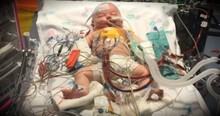 Miracle Baby Survives Surgery That Stopped His Heart For 15 Hours