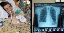 Doctors Get Creative to Give 'Fighting Chance' to Man with Flu Needing Double Lung Transplant