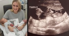 Nurse Goes Quiet During Ultrasound As She Realizes Woman Got Pregnant While Pregnant