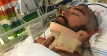 Heroic Dad Fights For Life After Diving Head First Off Balcony To Save His Son