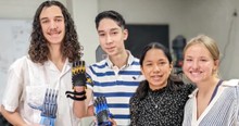 He Wanted To Keep His Abnormal Hand Hidden, But When Kids Found Out, They Changed His Life