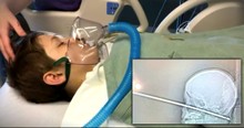 Family Credits God After Son Survives Horrific Face-First Fall Onto Meat Skewer