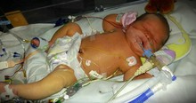 Miracle Baby Baffles Doctors When She Was Born With More Water In Her Body Than Blood