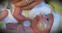 Born With No Kidneys, This Baby Is A True Miracle