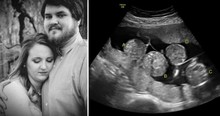 Woman Fearing Miscarriage 'Freaks Out' When Ultrasound Shows Rare Phenomenon