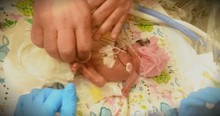 Miracle Baby With Feet The Size Of Pennies Overcame Meningitis
