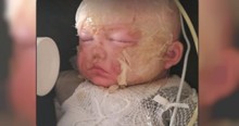 Two-Year-Old Survives Terrible Pressure Cooker Explosion