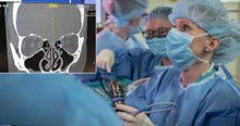 Doctor Makes Bizarre Discovery After Woman's Nose Runs Constantly For Years