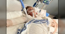 Science Experiment At Home Goes Horribly Wrong And 12-Year-Old Boy Needs Prayers