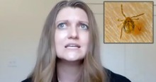 Woman Uncovers The Surprising Cause Of Her Sudden Red Meat Allergy -- A Tick Bite